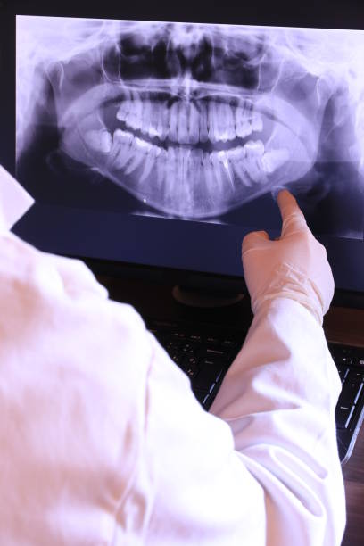 Best Emergency Treatment for Dental Infections or Abscesses in Forest Ranch, CA